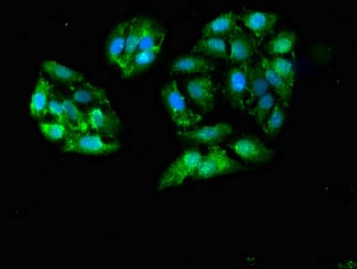 GALK1 / GK1 Antibody