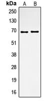 Polyclonal Rabbit anti-Human SPP1 / Osteopontin Antibody (C-Terminus, IHC, WB)