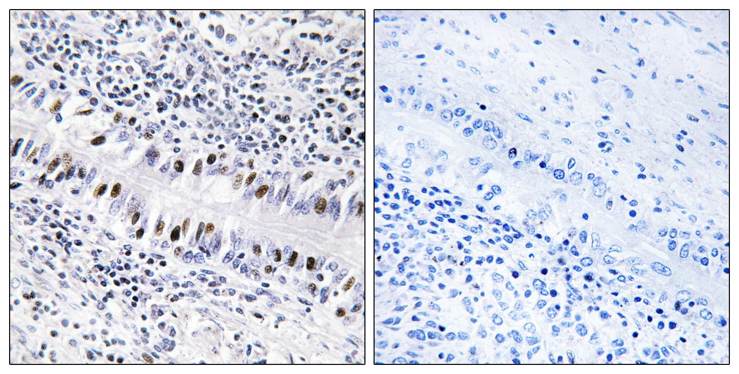 Polyclonal Rabbit anti-Human ZNF76 Antibody (aa116-165, IHC)