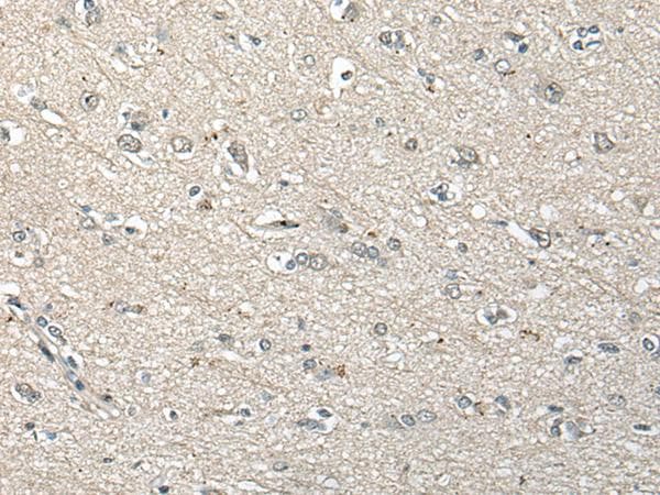 UCN3 / SPC Antibody