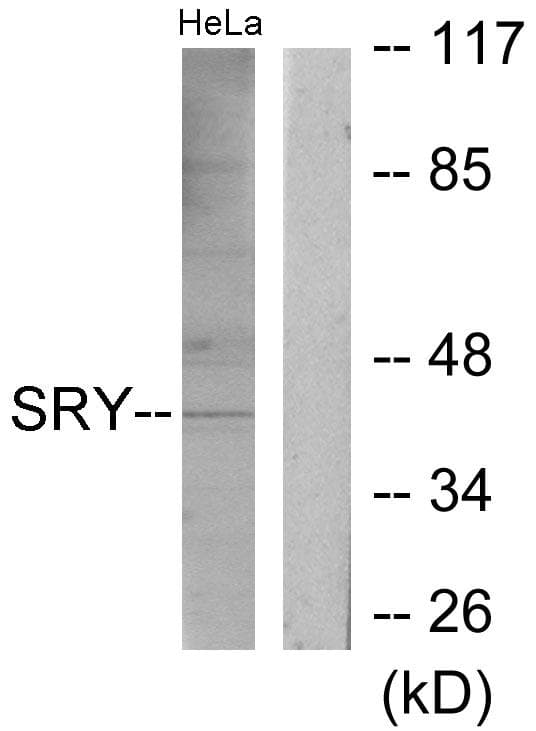 SRY Antibody