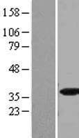 SRSF5 / SFRS5 Protein (Over-Expression Lysate Myc-DDK (Flag))