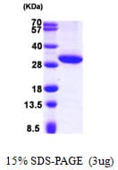 Human HSD17B11 Protein (Recombinant His)