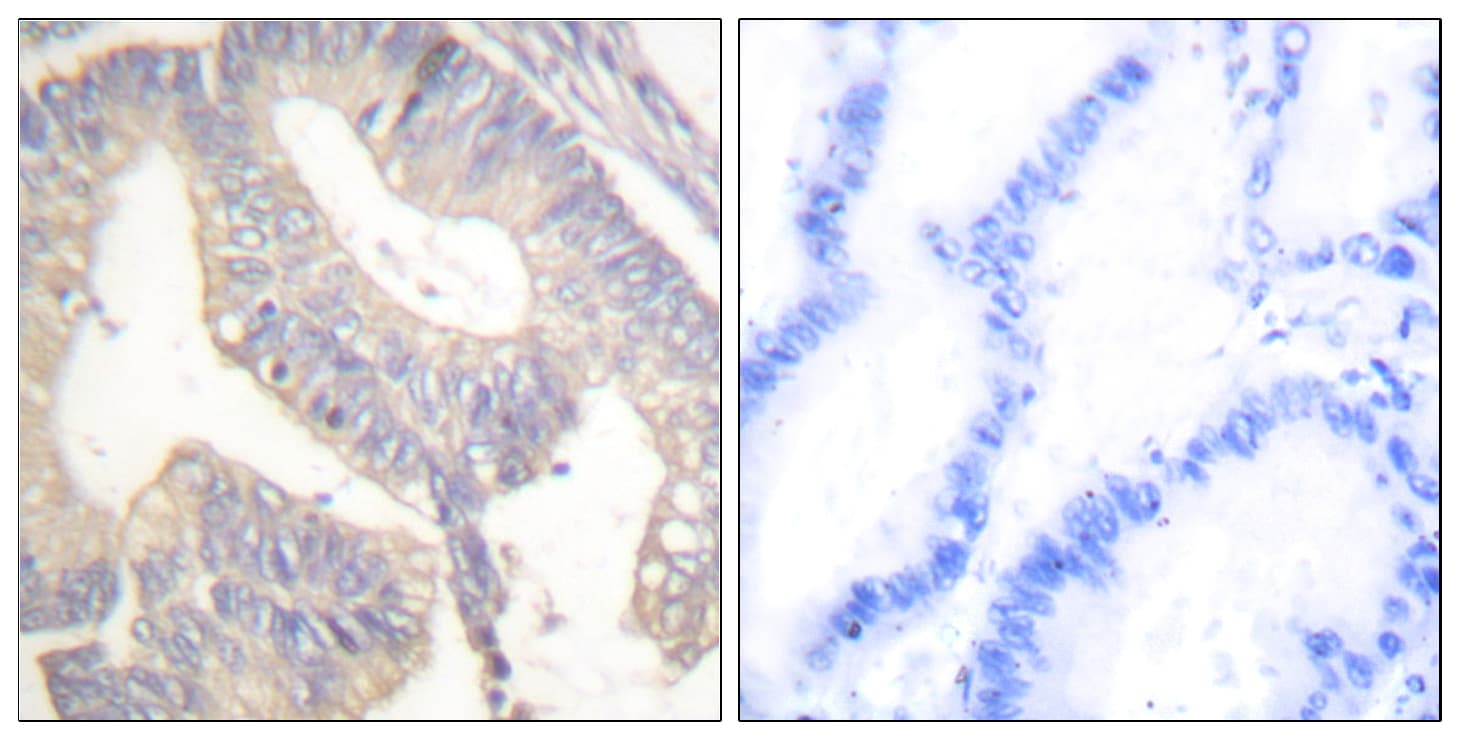 Gastrin Antibody (aa52-101)