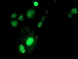 IHC-plus™ SAT2 Antibody (clone OTI2A3)