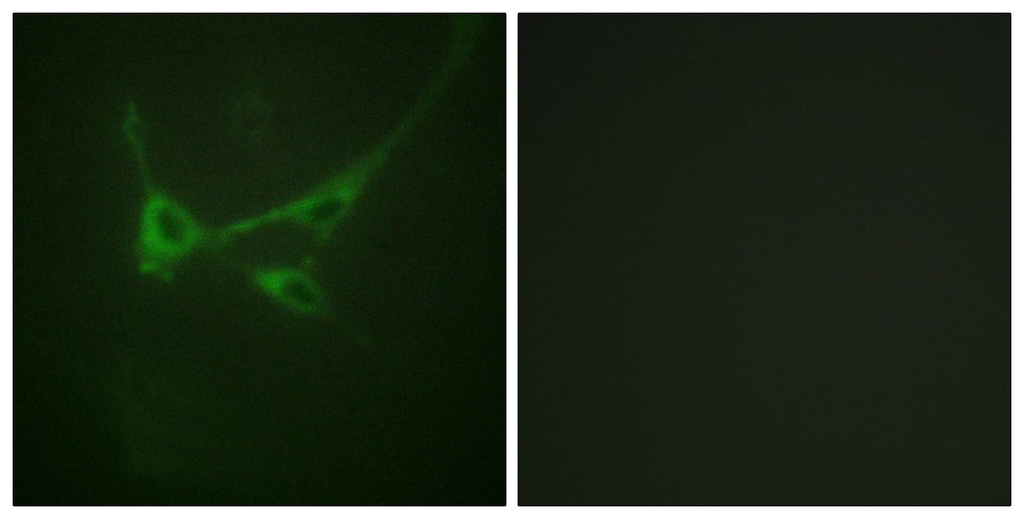 MTOR Antibody (phospho-Ser2481)