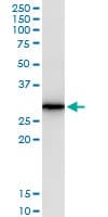 AREG / Amphiregulin Antibody (clone 3E4)
