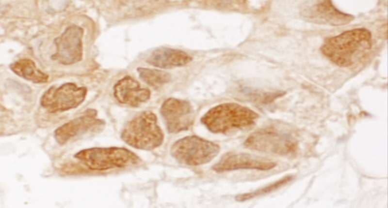 TIGAR Antibody (aa220-270)