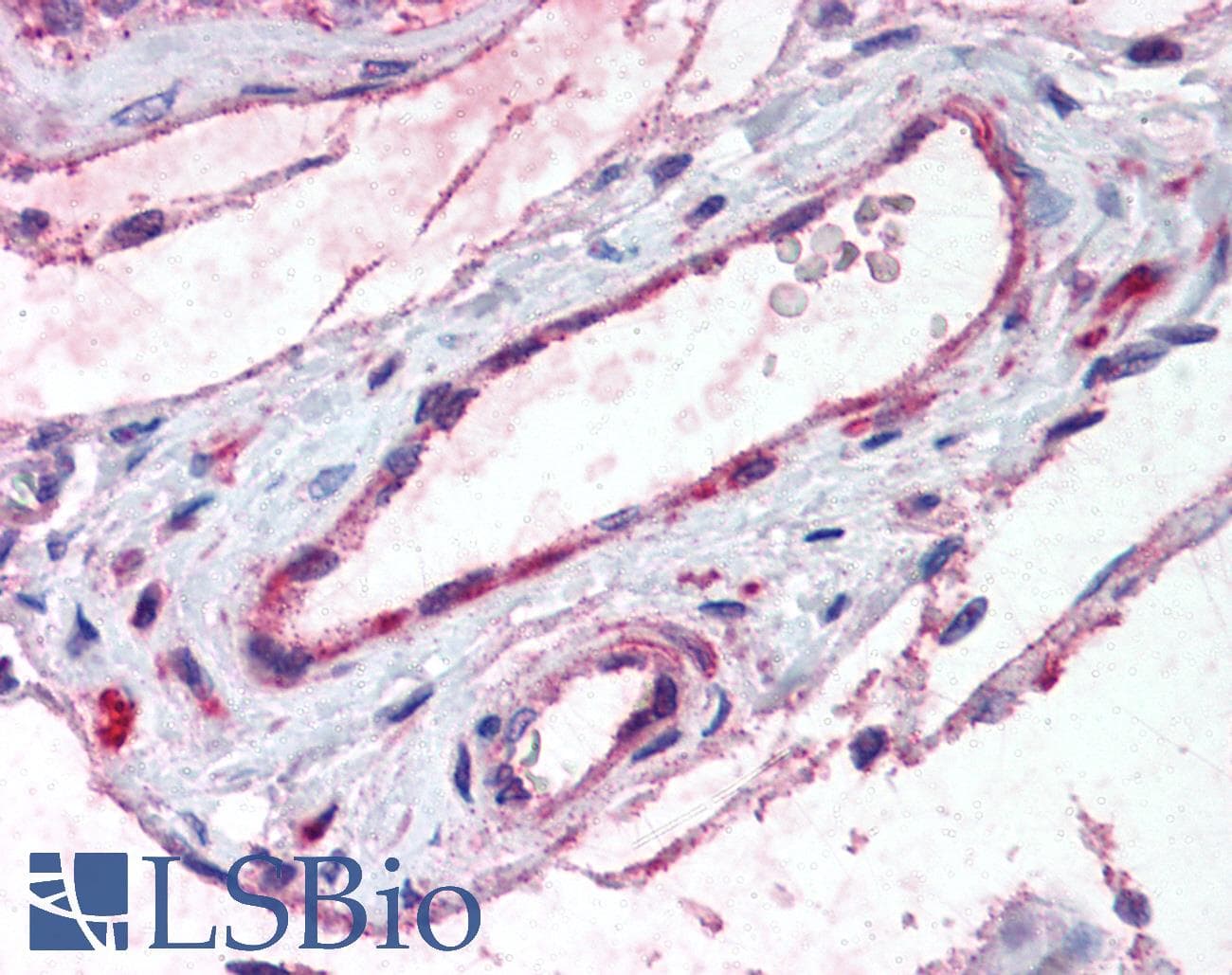 IHC-plus™ ADAMTS1 Antibody (Internal)