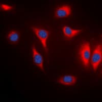 Polyclonal Rabbit anti-Human MARK1+2+3+4 Antibody (Internal, IHC, IF, WB)