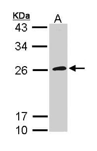 IHC-plus™ GP1BB / CD42c Antibody