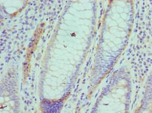 ARFGAP1 Antibody (aa1-220)