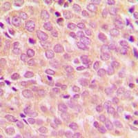 IRS1 Antibody (phospho-Ser794)