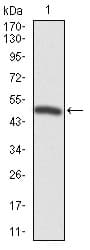 FOXP1 Antibody (clone 6E4)