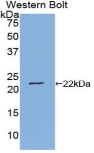 IL6 / Interleukin 6 Antibody (aa26-208)