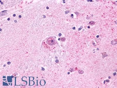 IHC-plus™ Polyclonal Rabbit anti-Human MCHR2 Antibody (C-Terminus, IHC)