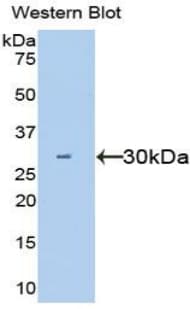 HGF / Hepatocyte Growth Factor Antibody (aa495-728, PE)