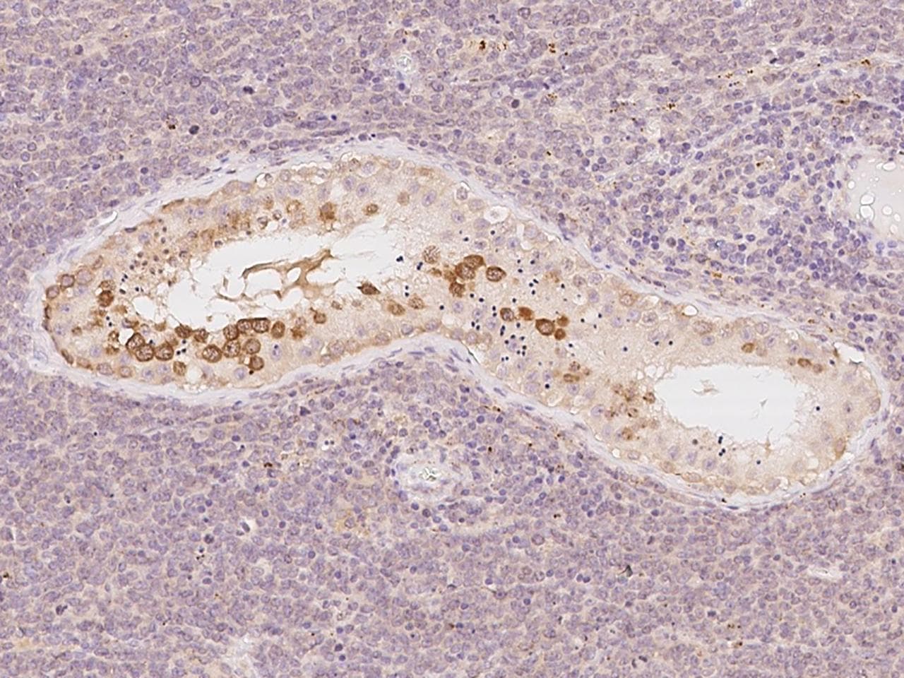 FKBP6 Antibody