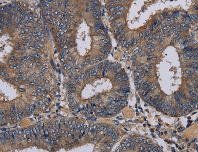 PVRL3 / Nectin-3 Antibody