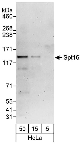SUPT16H / FACTP140 Antibody (aa997-1047)
