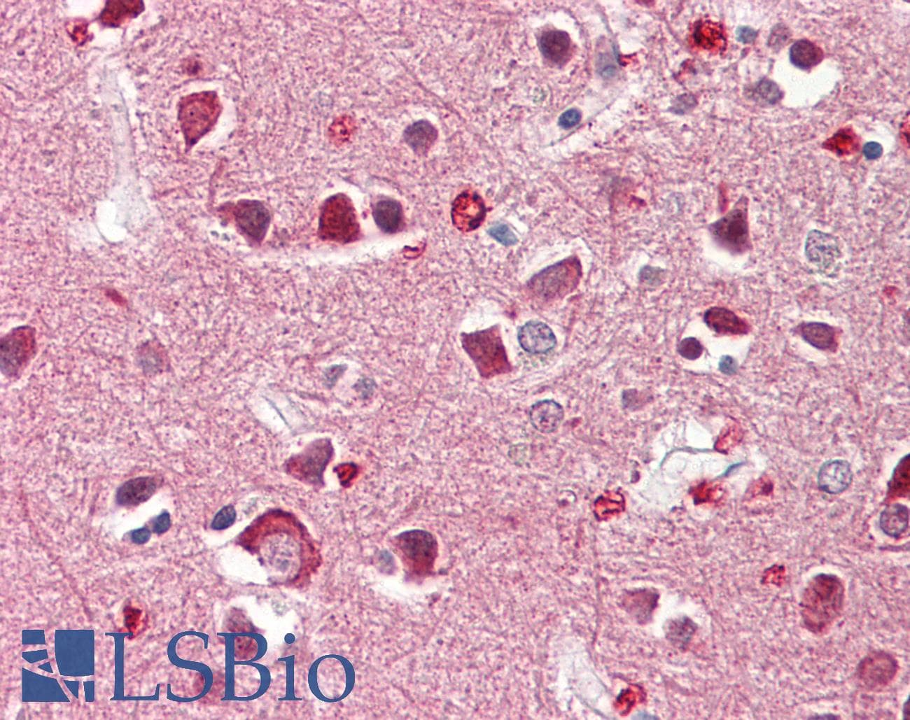 IHC-plus™ RIMS4 Antibody (aa33-82)