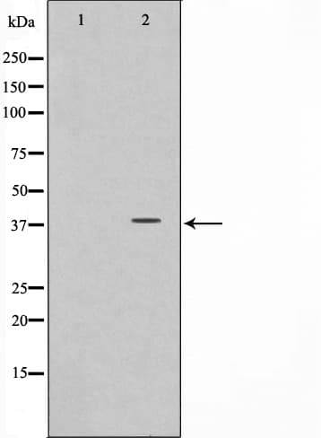 SYP / Synaptophysin Antibody