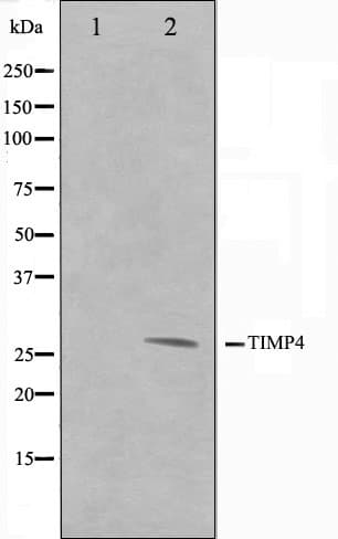 Polyclonal Rabbit anti-Human TIMP4 Antibody (IHC, IF, WB)