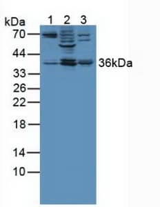 ANXA3 / Annexin A3 Antibody (aa190-312)