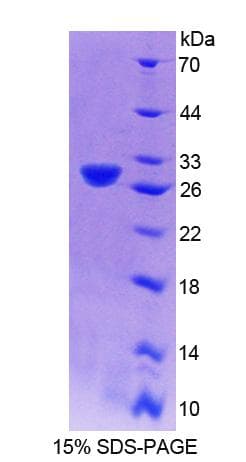 Mouse CENPJ / LAP Protein (Recombinant 6His, N-terminus)