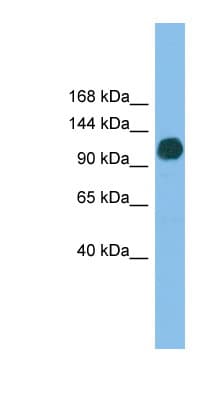 Polyclonal Rabbit anti-Human USP36 Antibody (aa71-120, WB)