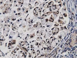 ERIC-1 / TACC3 Antibody (clone OTI3B1)