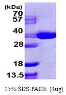 Human SEC13 Protein (Recombinant His)