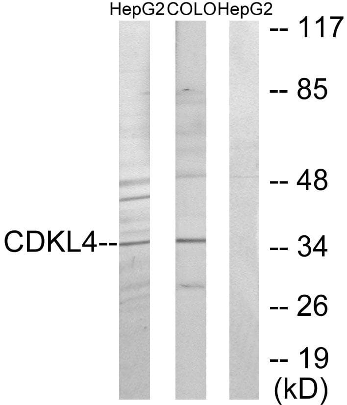 Polyclonal Rabbit anti-Human CDKL4 Antibody (IHC, IF, WB)