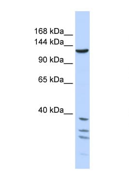 TNKS / Tankyrase Antibody (aa1079-1128)