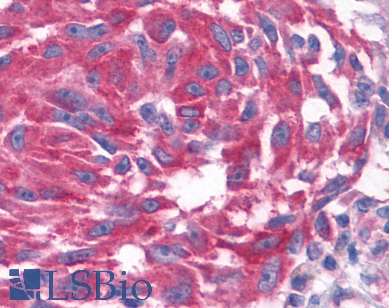 PathPlus™ GPR80 / GPR99 / OXGR1 Antibody (N-Terminus)