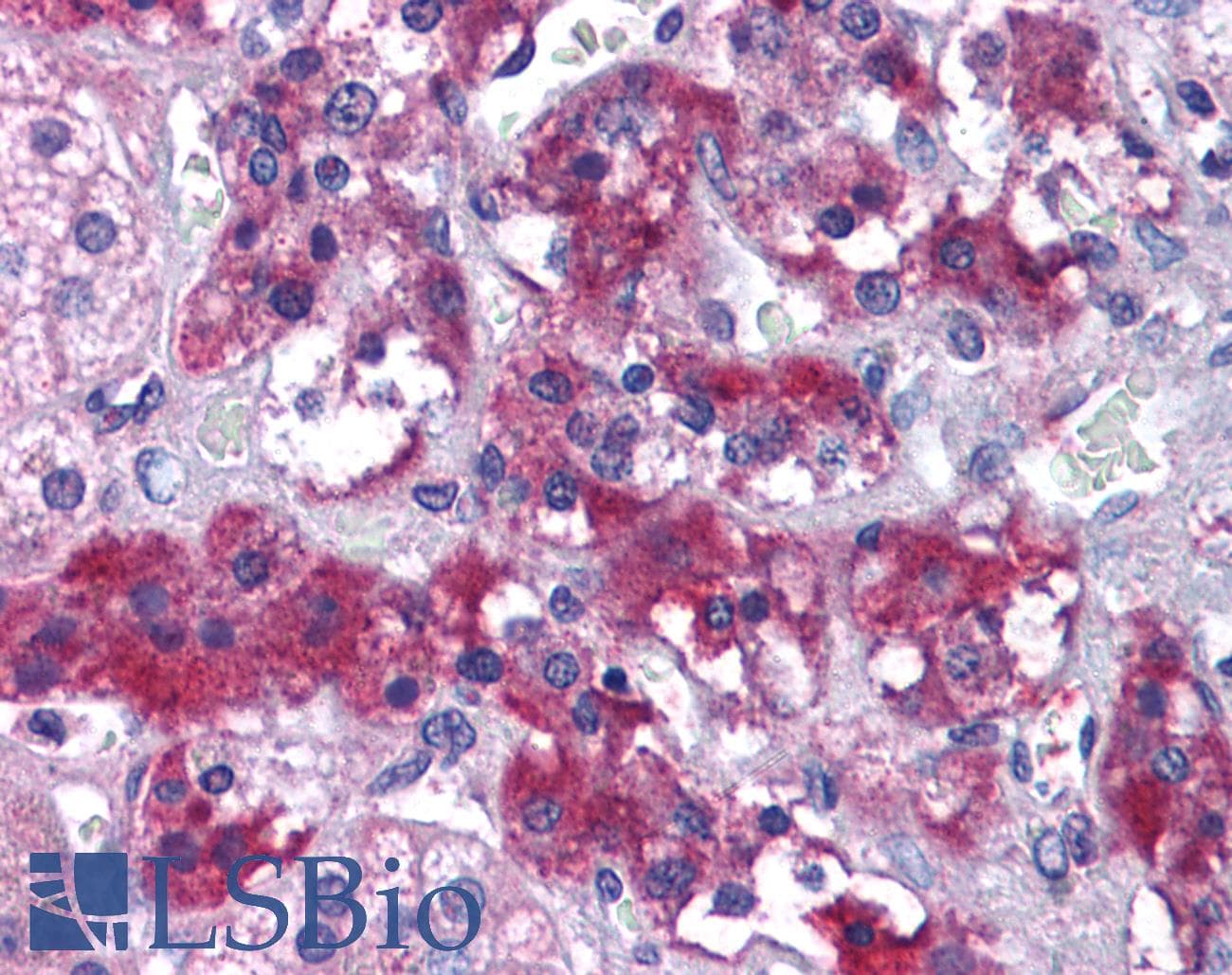 IHC-plus™ Polyclonal Goat anti-Human MER / MERTK Antibody (aa990-999, IHC)