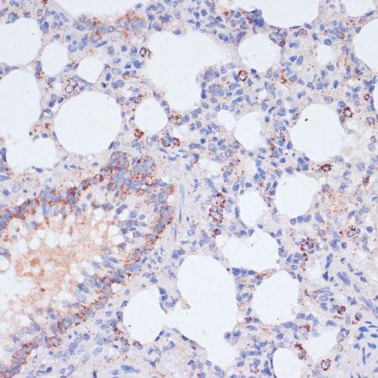 VASP Antibody