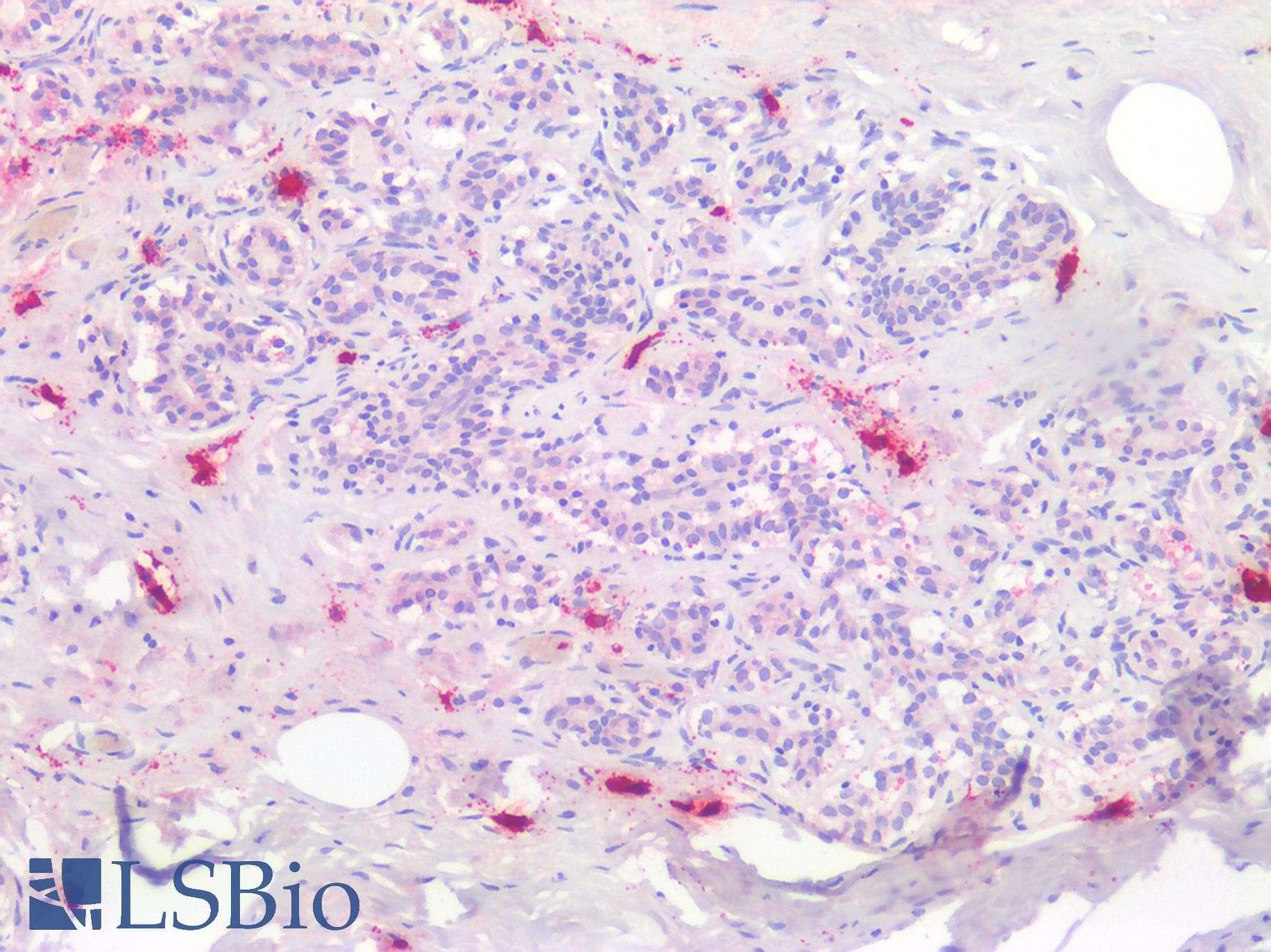 PathPlus™ Tryptase Antibody (aa161-262)