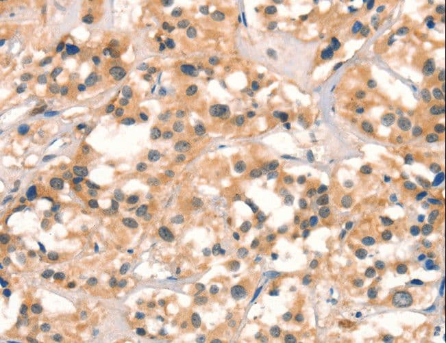 Polyclonal Rabbit anti-Human CUEDC2 Antibody (IHC)