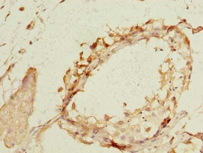 NEK11 Antibody