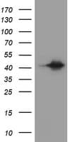AMACR / P504S Antibody (clone OTI4G5, Carrier-free)