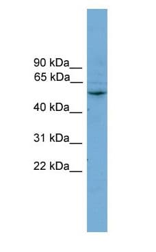 Polyclonal Rabbit anti-Human CYP2A7 Antibody (N-Terminus, WB)