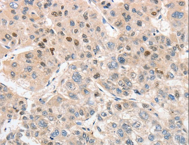ANAPC5 / APC5 Antibody