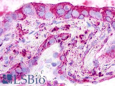 PathPlus™ Polyclonal Rabbit anti-Human GPR26 Antibody (Extracellular Domain, IHC)