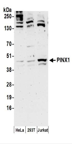 PINX1 Antibody (aa225-275)