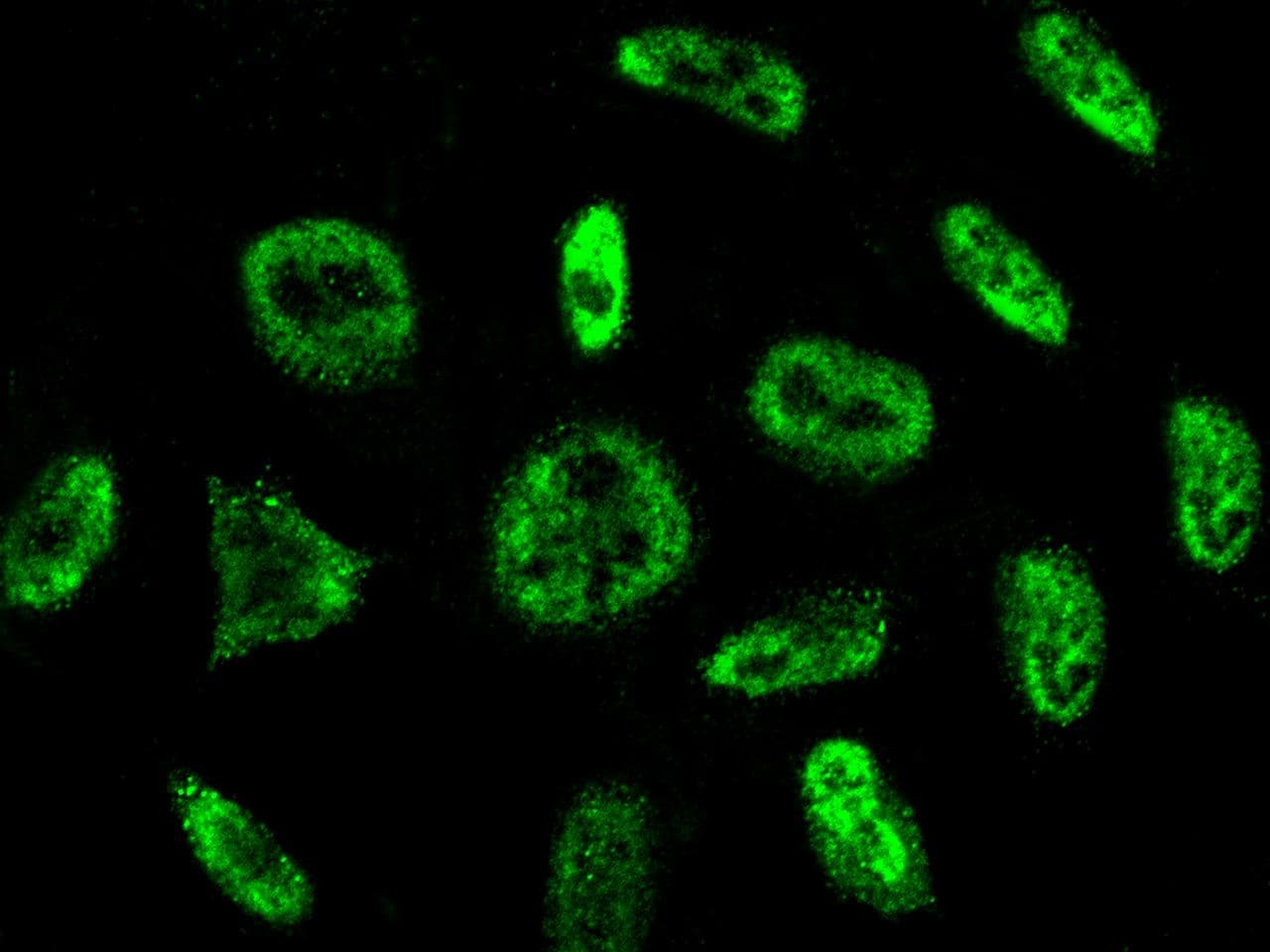 Polyclonal Rabbit anti-Human PRPF19 / PRP19 Antibody (Preservative Free, IHC, IF)