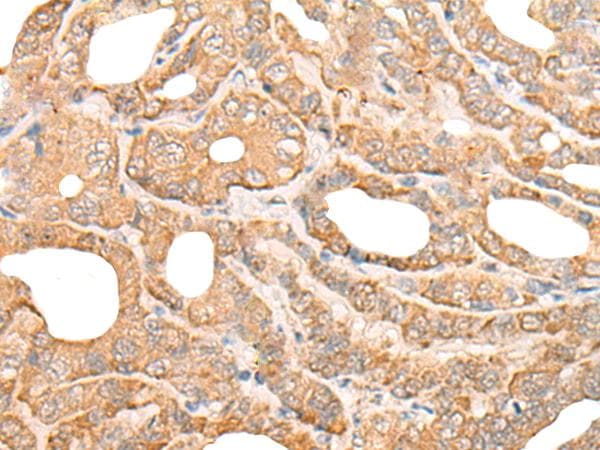Polyclonal Rabbit anti-Human DEF8 Antibody (IHC)