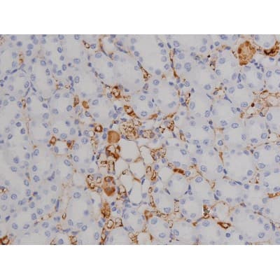 Polyclonal Rabbit anti-Human ZAP70 Antibody (phospho-Tyr319, IHC, IF, WB)
