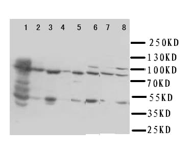 HSD17B4 Antibody (aa744-761)