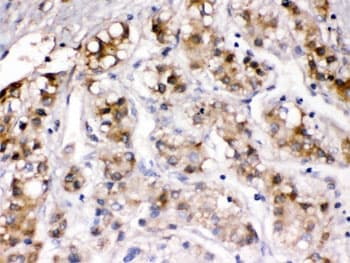 CP / Ceruloplasmin Antibody